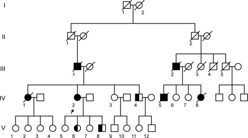 Figure 1 Pedigree of the family. Filled symbols, affected subjects; open symbols, unaffected; a diagonal line through a symbol, deceased; short arrow, proband; half filled symbols, mutation carrier; circles, female; squares, male. DNA available in IV2, IV3, IV4, V5, V6, V7, and V8. The proband was IV2 (arrow), a 51-year-old female with the MAPT P301L mutation presenting as bvFTD clinically. One sibling (IV4) and two children of the patient (V6 and V8) were healthy mutation carriers with the same mutation.