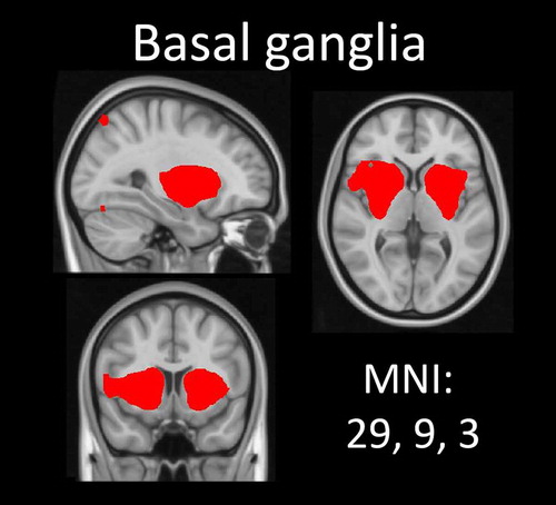 Figure 2. Basal ganglia network. This network was manually selected based on previous literature. Thresholded at 3 < z < 6.