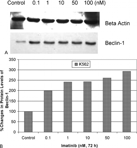 Figure 4. Protein levels of Beclin‐1 gene in response to imatinib in K562 cells. (A) Protein levels of Beclin‐1 gene in response to imatinib were determined by western blot. (B) Fold changes in protein levels were determined by densitometric analysis.