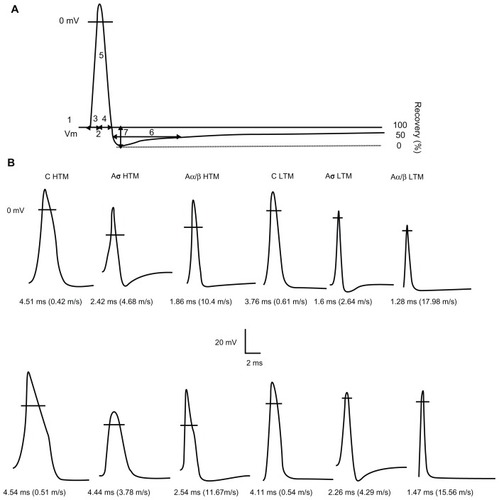 Figure 1 Examples of APs recorded from mechanoreceptive neurons. (A) Representative intracellular somatic action potential of an A-fiber neuron evoked by electrical stimulation of the dorsal root showing the electrophysiological parameters measured, including: 1, resting membrane potential; 2, action potential duration at base; 3, action potential rise time; 4, action potential fall time; 5, action potential amplitude; 6, AHP duration to 50% recovery; 7, and afterhyperpolarization amplitude below Vm. In addition, maximum rising and falling rates, (dV/dt) max, were measured from the differential trace of the action potential. (B) Somatic action potentials evoked by dorsal root stimulation and recorded intracellularly from 12 mechanoreceptive neurons selected to represent the mean action potential duration values for each of the different groups of neurons in control (upper) and neuropathic (lower) animals. The action potential duration and conduction velocity for each neuron are given below each record. The horizontal lines across the action potentials indicate zero membrane potential.