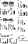 Figure 4 Effects of HOXA10 knockdown on p53 acetylation and HDAC1 transcription.Notes: Experiments were conducted in both HCC cell lines (SMMC-7721 and HepG2). (A) Western blot showed that HOXA10 knockdown enhanced p53 acetylation (Lys382). (B) qRT-PCR showed the effects of HOXA10 knockdown on HDAC1-3 mRNA expression. (C) Western blot showed the effects of HOXA10 knockdown on HDAC1 protein expression. (D) Luciferase assays showed that HOXA10 knockdown remarkably reduced the activity of the HDAC1 promoter. (E) ChIP analysis of HOXA10 binding to the HDAC1 promoter. (F) Pearson’s correlation analysis between HOXA10 and HDAC1 mRNA expression in HCC tissues (n=80). *P<0.05, **P<0.01 and ***P<0.001 compared to shNC. ^^P<0.01 and ^^^P<0.001 compared to IgG.Abbreviations: HOXA10, homeobox A10; HDAC1, histone deacetylase 1; HCC, hepatocellular carcinoma; qRT-PCR, quantitative real-time PCR; mRNA, messenger RNA; ChIP, chromatin immunoprecipitation; shNC, negative control shRNA.