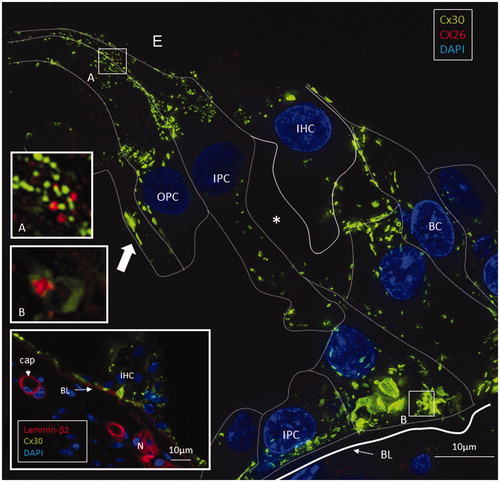 Figure 3. SR-SIM of the inner hair cell (IHC) region in a human cochlea (single optical plane). Cx30 is richly expressed, while Cx26 is hardly detectable. Outer pillar columns display prominent intercellular GJs (filled arrow). Inner pillar feet show large Cx30-positive areas facing the basal lamina (BL). Inset: Confocal micrograph of IHC region. The basal lamina of the epithelium, blood vessels, and neurons are stained for laminin β2. Frames A and B are magnified in insets. A: A few Cx26 GJ plaques are seen among the Cx30-positive GJs. B: An annular GJ with central Cx26-positive domains is seen in the pillar foot. BC: basal cell; E: endolymph; IPC: inner pillar cell; OPC: outer pillar cell.