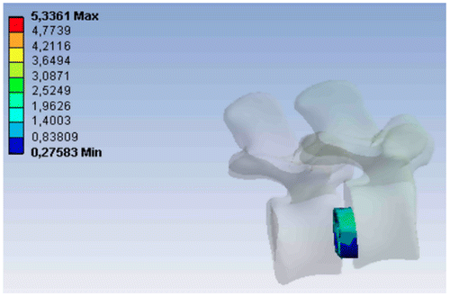 Figure 4. Von Mises stress distribution in second cage.