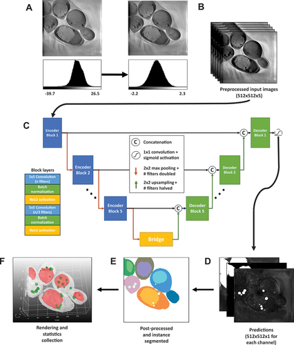 Figure 4. Workflow of LipoSeg for automated segmentation and architecture of the segmentation CNN. (A) to obtain comparable intensity statistics for all image data sets, tomogram reconstructions were first normalized using quantile normalization based on a gaussian distribution. (B) for model training, five sequential input slices were used for each stack of the training data and augmented by 90-degree rotations and elastic deformations. (C) the segmentation CNN model is based on the U-net architecture but with five sequential frames from a z-stack, which we found to minimize problems caused by the missing wedge problem. Each block consists of two iterations of convolution layers, batch normalization and ReLu activation unit, and blocks are connected by 2 × 2max pooling layers during the encoding phase (red arrows), and 2 × 2up-sampling layers during the decoding phase (green arrows). A sigmoid activation function is used as output, and each channel, i.e., entire cells, vacuoles and LDs, is trained as a separate model. During training, a compound loss function consisting of Dice and TopK binary cross-entropy is employed. (D) raw predictions for each channel are generated with probability of belonging to a given class, e.g., LDs, shown in grey scale intensity values. This is followed by instance segmentation using a watershed transformation for all three channels separately (E). The segmented stacks are then used for 3D rendering using a marching cube algorithm for mesh generation (F). This is shown here as top view of model output after 3D rendering showing cells in white, vacuoles in red and LDs in green exemplified for npc2∆ cells. Finally, the segmented 3D objects (LDs and vacuoles) are analyzed including calculation of volumes, distances etc. See main text for further details.
