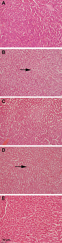 Figure 7 Histology images of rat’s liver with macrovesicular and microvesicular steatosis (magnification, 100x), where black arrows shows the fat droplets (A) liver of normal control group presenting normal hepatocytes; (B) liver of rat fed with HFD showing severe steatosis and fatty degeneration of hepatocytes; (C) liver of rat treated with standard botanical mixture along with HFD, showing moderate fatty degeneration of hepatocytes; (D) liver sections of rats fed with HFD and treated with safranal 250 mg/kg/day showing moderate fatty degeneration of hepatocytes; (E) liver sections of rats fed with HFD and treated with safranal 500 mg/kg/day showing mild fatty deposition.