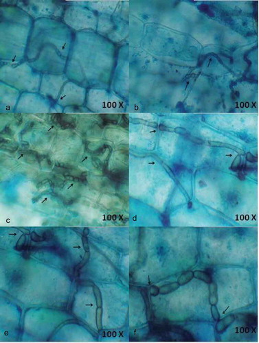 Figure 3. Localisation of endophytic fungi within seagrass tissue using lactophenol cotton blue (a-f) staining, closer view of septate fungal hyphae.