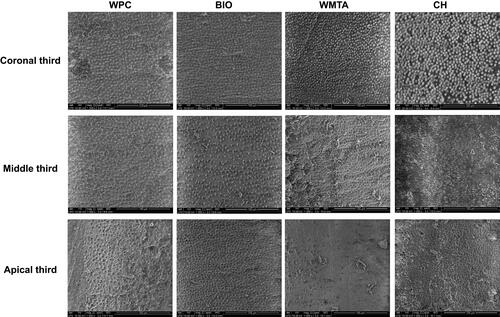 Figure 2 High power SEM (1000×) micrographs of a longitudinal section of the root canal retrieved from intracanal medicaments (WPC, BIO, WMTA and CH paste).