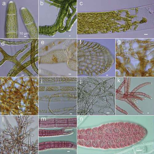 Figure 2. Micrographs of selected strains in KU-MACC. (a) KU-3047, Acrosiphonia spinescens (b) KU-1613, Ulva linza (c) KU-2994, Bryopsis corticulans (d) KU-1518, Codium hubbsii (e) KU-1152, Choristocarpus tenellus (f) KU-1072, Dictyopteris latiuscula (g) KU-1451, Macrocystis pyrifera (h) KU-1372, Ectocarpus siliculosus (i) KU-1335, Ectocarpus sp. (j) KU-1859, Pyropia tenera (k) KU-3141, Dasya sinicola (l) KU-2598, Galaxaura sp. (m) KU-948, Polysiphonia senticulosa (n) KU-971, Delesseria serrulata. Scale = 10 µm.