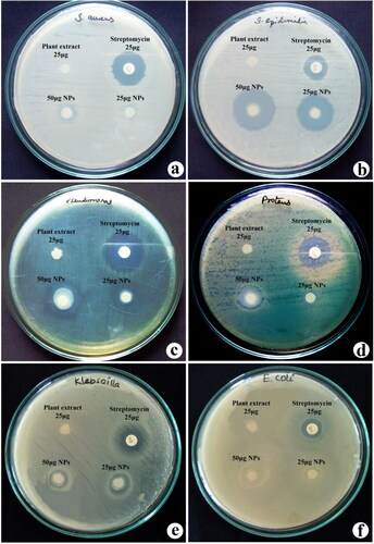 Figure 4. Antibacterial efficacy of synthesised nanotitania catalysts synthesised using aqueous rhizome extracts of G. superba against (a) S. aureus, (b) S. epidermidis, (c) P. aeruginosa, (d) P. vulgaris, (e) K. pneumoniae and (f) E. coli.