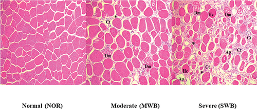 Figure 2. Histomicrograph of breast muscles affected by wooden breast (WB). Features of the muscle include degenerating muscle fibers (Dm), adipose tissue (Ap), hypertrophy of myofiber (Hc), and increased connective tissue (Ct) and extracellular matrix (*). HE, 200x.