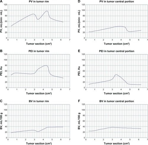 Figure 2 PV and BV increased when the tumor rim was in the range of 0.59–1.69 cm (0.35–2.85 cm2) in size; at 0.59–0.77 cm (0.35–0.6 cm2), PEI increased; at 1.69–1.79 cm (2.85–3.2 cm2), PV and BV decreased and PEI increased; at 1.79–2.10 cm (3.2–4.4 cm2), PV, BV, and PEI increased markedly; at 2.10–2.51 cm (4.4–6.3 cm2), PV and PEI decreased and BV stabilized (A–C). When the central portion of the tumor was in the range of 0.59–1.79 cm (0.3–3.2 cm2), PV, BV, and PEI increased significantly; at 1.79–2.19 cm (3.2–4.8 cm2), PV, BV, and PEI decreased significantly; at 2.19–2.51 cm (4.8–6.3 cm2), PV and BV increased slowly and PEI decreased slowly (D–F).