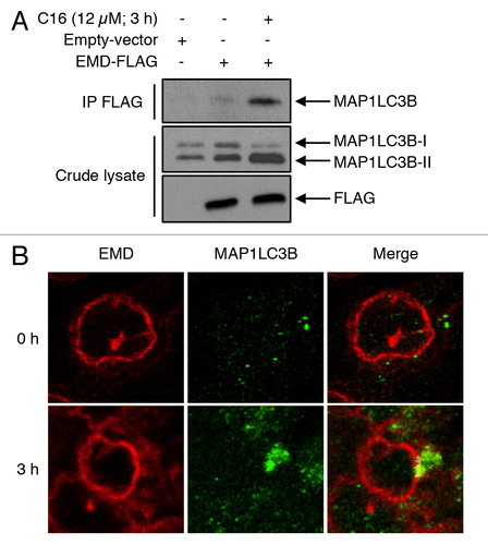 Figure 6. EMD binds MAP1LC3B upon ceramide treatment. (A) Cells were transfected with EMD-FLAG or with empty vector and then treated with or without C16-ceramide for 3 h. After immunoprecipitation of FLAG, MAP1LC3B was revealed by western blotting using an anti-MAP1LC3B antibody. (B) Representative fluorescent images of HCT116 cells untreated or treated with C16-ceramide for 3 h and stained with both anti-EMD and -MAP1LC3B antibodies. Cells were analyzed with confocal microscopy.
