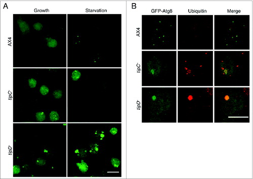 Figure 3. The pattern of GFP-Atg8 is altered in tipC− and tipD− cells. (A) In vivo confocal analysis of cells expressing GFP-Atg8 in growing and starvation conditions. Puncta formation is inhibited in starved tipC− cells compared with AX4. In contrast, large aggregates of the autophagosome marker are evident in tipD− cells in both growing conditions. (B) Immunofluorescence of ubiquitin in the cells expressing GFP-Atg8 demonstrates the presence of ubiquitin-positive protein aggregates in both mutants. The ubiquitin structures are smaller in tipC− cells and do not always colocalize with GFP-Atg8, while the autophagosome marker is clearly contained in the large tipD− ubiquitinated aggregates. Scale bar: 10 μm.