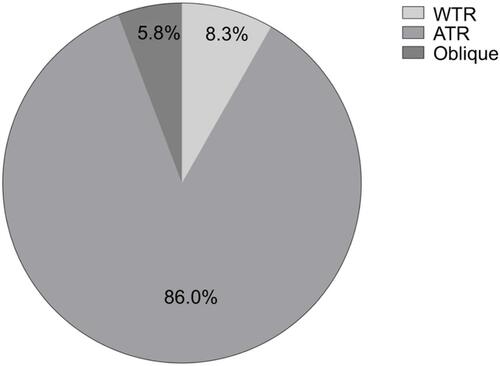 Figure 2 Distribution of axial of PCA at 3-mm corneal diameter.Abbreviations: PCA, posterior corneal astigmatism; WTR, with-the-rule; ATR, against-the-rule.