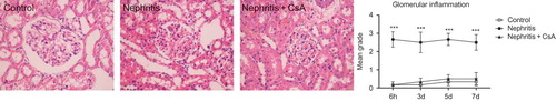 Figure 2.  Glomerular inflammation in rat kidneys during the experimental period and histological appearances of kidneys in control (grade 0, at sixth hour), nephritis (grade 3, at sixth hour), and nephritis + CsA (grade 0, at sixth hour) groups. Values are expresed as mean ± SEM. n = 6 at each time point for each group. Notes: ***Denotes p < 0.001 against control and nephritis + CsA groups. CsA, cyclosporine A.