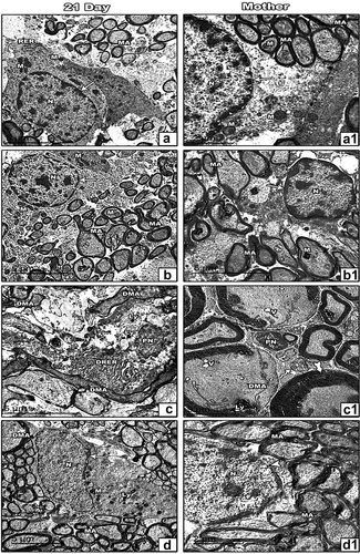 Figure 5. Transmission electron micrographs of the optic nerve of 21-day-old offspring (a-d) and mother (a1-d1) rats; Control (a&a1) and ZnO NPs treated group (b&b1) showing normal nucleus, normal myelinated axons, normal mitochondria; 21-day-old offspring rats their mothers treated with LPS showing degenerated myelinated axons, pyknotic nucleus, dilated rough endoplasmic reticulum and lysosomes (c). Mother treated with LPS showing vacuoles, demyelination, increasing thickness of myelin sheath and pyknotic nucleus (c1). 21-day-old offspring and their mother rats treated with LPS and ZnO NPs showed structural improvement (d&d1). Abbreviations: DMA indicating degenerated myelinated axon; DRER indicating dilated rough endoplasmic reticulum; LY indicating lysosomes; M indicating mitochondria; MA indicating myelinated axon; N indicating nucleus; PN indicating pyknotic nucleus; RER indicating rough endoplasmic reticulum; V indicating vacuoles; Arrow indicating regular nuclear membrane; Arrowhead indicating irregular nuclear membrane; Wavy arrow indicating phagosomes; Tailed arrow indicating thick myelin sheath.
