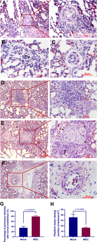Figure 6 Transplantation of MSCs alleviated the histologic features of PAH. (A–E) Representative photographs of small pulmonary arteries from birds treated with PBS (mock group) showing (A) loss of endothelial cells, (B) eccentric intimal thickening (arrow), (C) endothelial proliferation, (D) an immature lesion, and (E) a mature glomeruloid-like plexiform lesion (arrowhead) with perivascular inflammatory infiltrates (arrow). (F) A small pulmonary artery from a bird treated with MSCs (MSC group) showing intact vascular endothelium. (G) Percentage of arterioles with normal endothelium. At least 20 arterioles with an outer diameter < 50 μm were randomly selected in each slide for analysis. Data are expressed as mean ± SEM of six birds. (H) Plexiform lesion density in the lung. Data are expressed as mean ± SEM of at least three birds.
