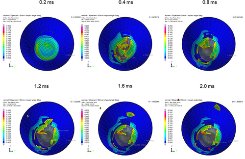 Figure 19 Sequential strain strength response of ocular surface of model eye upon airbag impact in straight position at 50 m/s with adhesion strength of scleral flap of 30%, shown at 0.4-ms intervals after 0.2 ms. Strain strength change is displayed in color as presented in the color bar scale (Figure 2).