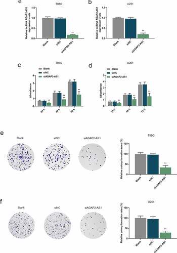 Figure 2. Knockdown of AGAP2-AS1 inhibited proliferation of glioma cells. (a-b) The expression of AGAP2-AS1 in U251 and T98G cells transfected with small interfering RNA targeting AGAP2-AS1 (siAGAP2-AS1) or its negative control (siNC) was evaluated by qRT-PCR assay. GAPDH was utilized as the internal control. (c-d) The viability of U251 and T98G cells was determined by Cell Counting Kit-8 (CCK-8) assay. (e-f) The proliferation of U251 and T98G cells was determined by colony formation assay. **P< 0.01 vs. siNC group. All experiments were performed in triplicate and data were presented as mean ± SD.