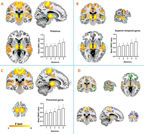 Figure 2 Significant time effects for VMHC (ANOVA). (A) ANOVA results for bilateral thalamus and time course during sleep deprivation. (B) ANOVA results for bilateral superior temporal gyrus and time course during sleep deprivation. (C) ANOVA results for bilateral precentral gyrus and time course during sleep deprivation. (D) Default-mode network and sensorimotor network marked green and blue, respectively.