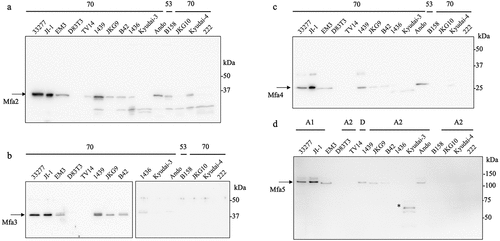 Figure 8. Detection of accessory proteins of various Porphyromonas gingivalis strains. Lanes were loaded with 10 µg (a – c) or 20 µg (d) of WCL. (a) Immunoblot analysis against Mfa2 (genotype 70) protein. (b) Immunoblot analysis against Mfa3 (genotype 70) protein. (c) Immunoblot analysis against Mfa4 (genotype 70) protein. (d) Immunoblot analysis against Mfa5 (genotype A1) protein. A potential degradation product is indicated by an asterisk.