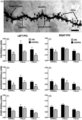 Figure 6. (A–G) Effect of CRS on the density of dendritic spine subtypes. (A) Photomicrograph of a dendritic segment with examples of thin, stubby and mushroom-shaped spines. Scale bar = 5 μm. (B and C) CRS significantly reduced overall density of thin spines in both left (B) and right (C) PFC callosal neurons; this effect was more pronounced in left PFC neurons, particularly on distal ( > 150 μm) dendrites. (D and E) CRS decreased the overall density of mushroom-shaped spines in both hemispheres; significant CRS-induced loss of mushroom-shaped spine was localized to distal dendrites (>150 μm) of left PFC neurons (D) and to the proximal dendrites (<150 μm) of right PFC neurons (E). (F and G) CRS had no significant effect on the density of stubby spines of either left (F) or right (G) PFC neurons.