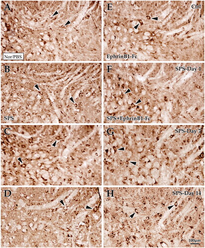 Figure 2. Immunohistochemical exploration of EphB2 in the spinal dorsal horn. Panels (A–D) show EphB2+ cells in the dorsal horn of the lumbar cord of the control group (A), Day 1 group (B), Day 7 group (C), and Day 14 group (D) in SPS. Panels (E–H) correspond to the SPS + EphrinB1-Fc of the control group (E), Day 1 group (F), Day 7 group (G), and Day 14 group (H). “Ctrl” corresponds to the control, and Day 1, Day 7, and Day 14 correspond to days 1, 7, 14 after SPS, respectively. All images are at the same magnification, scale bar = 100 μm. Black arrows indicate positive cells.