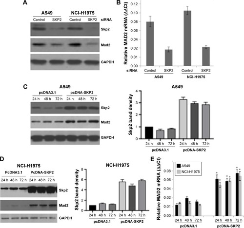 Figure 1 Silencing of SKP2 by siRNA led to decrease of MAD2 expression in A549 and NCI-H1975 cells.