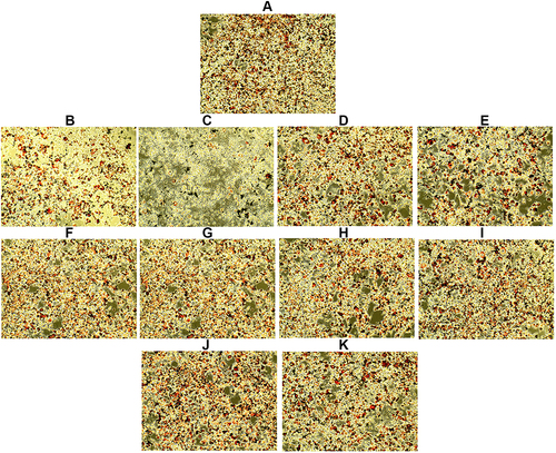 Figure 7 Lipid accumulation in differentiated 3T3-L1 cells treated with different concentrations of extracts, as observed by an EVOS XL microscope at 10× magnification after ORO staining. (A) Control, (B) A. lacucha 50 µg/mL, (C) A. lacucha 100 µg/mL, (D) L. monopetala 50 µg/mL, (E) L. monopetala 100 µg/mL, (F) D. sparsa 50 µg/mL, (G) D. sparsa 100 µg/mL, (H) A. nepalensis 50 µg/mL, (I) A. nepalensis 100 µg/mL, (J) L. ovalifolia 50 µg/mL, and (K) L. ovalifolia 100 µg/mL. Red dots represent ORO-stained lipid droplets, and reduced density of stained droplets in extract-treated groups indicates anti-adipogenic activity of those extracts.