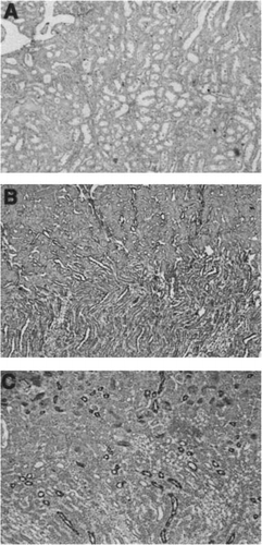 Figure 4. Immunohistochemistry for TGF-α. (A) Injury section stained with control serum alone. (B) control kidney section stained for TGF-α. (C) Cortical section from a rat treated with HgCl2 4 mg/kg at day 3. Staining was confined to distal tubules in control kidneys whereas it was more pronounced following the induction of injury. Similar observations were made in multiple other sections from 5 animals.