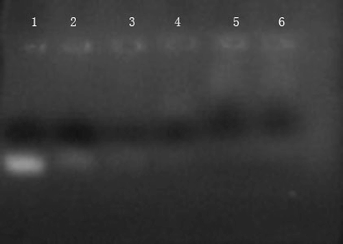 Figure 4.  Agarose gel electrophoresis of CSLP-ASON complexes. Lanes from left to right: uncomplexed ASON (50 mg/L, Lane 1); CSLP-ASON complexes prepared at mass ratios of 1, 5, 25, 50, and 100 (from Lane 2 to Lane 6).