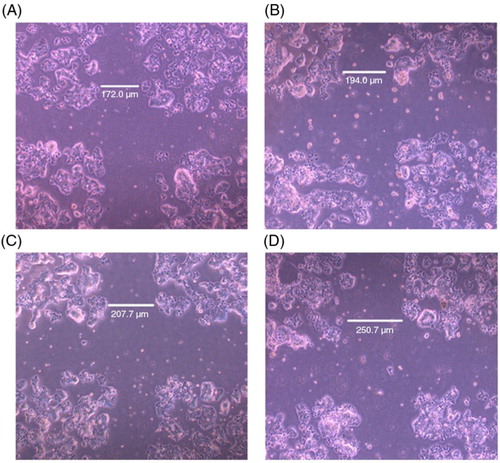 Fig. 4 Effect of trigonelline on the migration of Hep3B cells as revealed by the wound assay. Hep3B cells were wounded as described in the Materials and Methods section. After washing, fresh culture medium, containing vehicle alone or various concentrations of trigonelline, was added. Photographs were taken after 48 h of incubation in the absence (A) or the presence (B–D) of trigonelline. Concentrations of trigonelline: 50 µM (B), 75 µM (C), and 100 µM (D). Results are representative of three independent experiments.