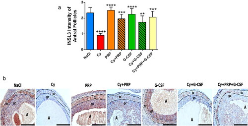 Figure 4. (a) INSL3 intensity of antral follicles. ++++ p < .0001, compared to group 1; ** p < .01, *** p < .001, **** p < .0001, compared to group 2. (b) Immunohistochemical analysis of INSL3 in the antral follicles of ovaries. Immunoreactivity of INSL3 was detected as brown staining. Strong INSL3 staining was observed in the follicular theca and granulosa cell layer in NaCl, PRP and G-CSF groups. Weakly INSL3 staining was detected both follicular theca and granulosa cell layer in Cy group. Moderate INSL3 staining was observed in Cy + PRP, Cy + G-CSF and Cy + PRP + G-CSF groups. A, antrum of antral follicle; tc, follicular theca cell layer; gc, granulosa cell layer. All figures include same magnification. Bar: 200 μm.