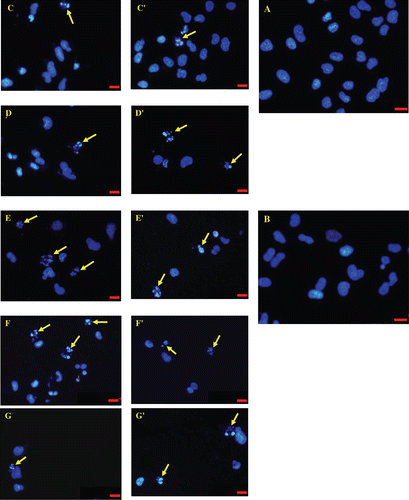Figure 4.  Chromatin condensation and observation of apoptotic bodies on A549 cell cultures evaluated after 12 h, stained with DAPI. (A) Control. (B) Cells treated with DMSO. (C-D-E-F-G) Cells treated with Pt(phen)Cl2 2,5-5-10-20-40-80 µM, respectively. (C’-D’-E’-F’-G’) Cells treated with [Au(phen)Cl2]Cl 2,5-5-10-20-40-80 µM, respectively. Arrows show classical apoptotic bodies. Scale bars 20 µM.