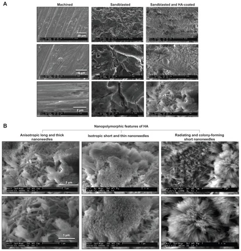 Figure 2 Creation of nanopolymorphic hydroxyapatite on microroughened titanium. Three different surfaces were prepared from Grade 5 titanium alloy (Ti-6Al-4V). (A) Low- and high-magnification scanning electron microscopic images of machined, sandblasted, and sandblasted + hydroxyapatite-coated surfaces. (B) Further close-up scanning electron microscopic images of the sandblasted + hydroxyapatite-coated surfaces showing nanopolymorphic features of nanoscale needle-like architectures in various diameters, lengths, and orientations.Abbreviation: HA, hydroxyapatite.