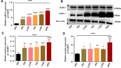 Figure 2 Gamma radiation activates Nod-Like receptors genes of NLRP-1 and NLRP-3 inflammasome in microvascular endothelial cells.