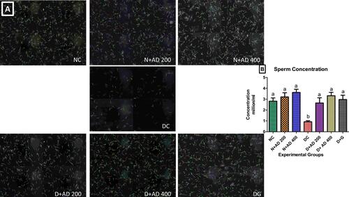 Figure 5 Sperm concentration of normal, diabetic and treated diabetic rats; (A) representative micrographs and (B) quantitative graphical representation. Bars are indicative of mean values ± SEM of group values. Bars with different letters are significantly (p<0.05) different from each other. Each plate in (A) comprises of four different fields of the semen sample.