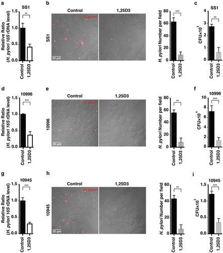 Figure 8. Antibiotic-resistant H. pylori strains were efficiently cleared by 1,25D3 at a physiological concentration. (a–i) HFE145 cells were infected with the H. pylori SS1, 10996 and 10945 strains (MOI 100) and treated with 1,25D3 (200 nM, 72 h). (a,d,g) Intracellular H. pylori DNA levels were measured by real-time PCR, detecting H. pylori-specific 16S ribosomal DNA. GAPDH was used as the internal control. (b,e,h) Cells were stained to visualize H. pylori (red). Thirty visual fields from each group were randomly selected to count bacteria number. Scale bar: 20 µm. (c,f,i) Cells were permeabilized with 0.5% saponin for 15 min at room temperature, and then plated on blood agar plates with serial dilution, and cultured for 1 week to count colony number. All the quantitative data are presented as means ± S.E.M. from 3 individual experiments. **P < 0.01; ***P < 0.001.