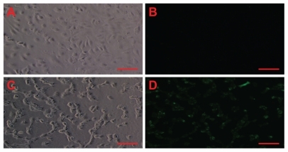 Figure 3 Amorphous SiNP induce oxidative/nitroxidative stress in primary human umbilical vein endothelial cells. As denoted by green fluorescence, exposure of cells to 10 μg/mL 10SiNP for 1 hour induced free radical production (D) when compared with the control in the absence of nanoparticles (B). The corresponding phasecontract micrographs of control (A) and treated (B) cells suggest cell death by necrosis induced by SiNP.Note: Scale bars represent 100 μm.Abbreviation: SiNP, silica nanoparticles.