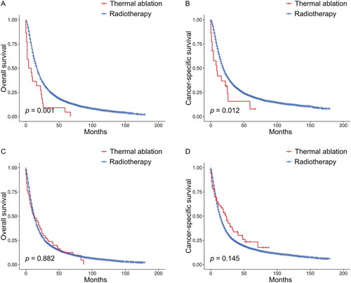Figure 5. Kaplan–Meier survival curves between the thermal ablation and radiotherapy groups when TNM substage was IIIA (A, B) or IIIB (C, D) before PSM. PSM: propensity score matching.