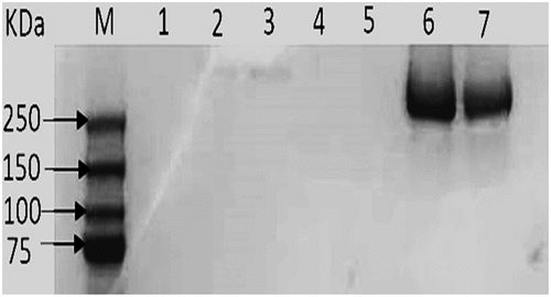 Figure 3. SDS polyacrylamide gel electrophoresis of the LDL. Lane M, show band corresponding to standard proteins with varying molecular weights (Da). Lane 6 and 7 were samples from separated LDL
