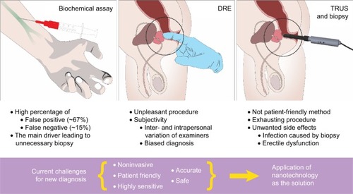 Figure 2 Current conventional approach of prostate cancer diagnosis.Notes: Current conventional diagnostic methodologies for the patients with prostate cancer hold several drawbacks. Patients with PSA levels 4–10 ng/mL are subjected to further examinations. The assay gives a significant number of false positives, which raises a question of its reliability. Concurrently, DRE is performed in an initial screening for prostate cancer but introduces subjectivity to the examination. The last method is TRUS, which takes a visual image of the tumor tissue in the gland, and, in most cases, biopsies are performed with a risk of potential infections from the rectum. Due to the drawbacks of current diagnosis, a novel, noninvasive, effective, initial screening prior to diagnosis is in high demand with excellent sensitivity and accuracy.Abbreviations: DRE, digital rectal examination; PSA, prostate-specific antigen; TRUS, transrectal ultrasonography.