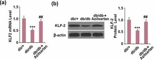 Figure 4. Azilsartan inhibited the expressions of KLF2 in brain vessels of diabetic mice. (A). mRNA of KLF2; (B). Protein of KLF-2 (***, p < 0.005 vs. db/+ group; ##, P < 0.01 vs. db/db group)