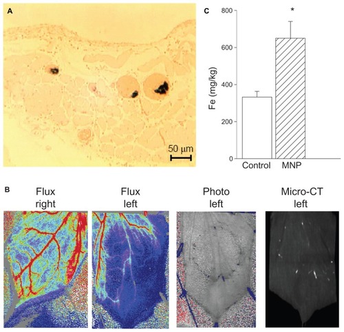 Figure 3 A magnetic field caused magnetic nanoparticle (MNP) retention in cremaster vasculature. In response to accumulative doses of MNPs (10 mg/kg; i.a.), MNP retention in the cremaster vasculature was demonstrated with Prussian blue staining (A). Both photo images and an image from a micro-CT scanner demonstrate MNP retention in the left cremaster muscle of a representative rat, which is associated with reduced tissue perfusion (B).Notes: Quantitative analysis of cremaster tissue iron content by inductively coupled plasma optical emission spectroscopy at the end of the experiment is illustrated (C; n = 5). Values are presented as mean ± SE. *P < 0.05 compared with the control group.