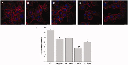 Figure 4. Cytoskeleton morphology and fluorescence intensity of MG-63 cells treatment with AgNPs and after termination of AgNPs treatment. A-E: Observation of cytoskeleton morphology (CLSM ×20). A: control; B: 0.5 μg/mL AgNPs treatment for 72 h; C: Termination of 0.5 μg/mL AgNPs treatment for 72 h; D: 5 μg/mL AgNPs treatment for 72 h; E: Termination of 5 μg/mL AgNPs treatment for 72 h. F: Fluorescence intensity of MG-63 cells cytoskeleton (*p < .05 vs. control, # p < .05 vs. T-5 μg/mL). con: control group; 0.5 μg/mL: 0.5 μg/mL AgNPs exposure for 72 h; T-0.5 μg/mL: termination of 0.5 μg/mL AgNPs exposure for 72 h; 5 μg/mL: 5 μg/mL AgNPs exposure for 72 h; T-5 μg/mL: termination of 0.5 μg/mL AgNPs exposure for 72 h)