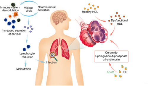 Figure 3 Role of the lymphocytes and HDL in COPD. A vicious circle produced by neurohumoral activation and immune system demodulation increases the secretion of cortisol, which causes the lymphocyte reduction. Lymphopenia possesses a higher risk of respiratory tract infections and malnutrition. As for HDL, COPD states trigger HDL to be dysfunctional and pro-inflammatory. And apolipoprotein M (apoM), as variations of a component of HDL, is implicated in COPD pathogenesis with HDL, especially emphysema, via effecting ceramide, sphingosine-1-phosphate cellular levels and α1-antitrypsin. Lymphocyte reduction and HDL conspire to deteriorate COPD status.