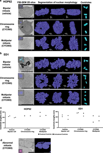 Figure 4. FIB-SEM reconstructions of nuclear morphology and centriolar structures are shown for: (a) human HOP62 and (b) murine ED1 lung cancer cells. FIB-SEM two-dimensional representative slice images, segmentation of nuclear morphology with 0-, 45- and 90-degree angles presented, respectively, and centriole three dimensional images are displayed. (c) Unlike the normal lengths of coupled centrioles in these images of some of the cells in panels a and b, cells with single centrioles exhibited centrioles with altered lengths, as shown in this panel (on left is human HOP62 and on right murine ED1 lung cancer cells). (d) a representative CYC065-treated HOP62 lung cancer cell exhibited abnormal nuclear morphology by FIB-SEM measurements. Purple signals indicated NucSpot live 650 DNA dye staining and teal images displayed condensed chromosomes and centrioles, respectively.