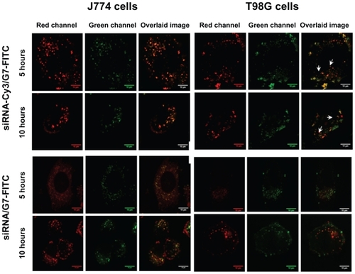 Figure 5 Confocal laser scanning microscopic images of cells incubated with siRNA-Cy3/G7-FITC and cells incubated with siRNA/G7-FITC where acidic endolysosomal compartments were stained with LysoTracker Red DND-99.Note: Arrows indicate colocalization dots (yellow-orange).Abbreviations: siRNA, small interfering RNA; FITC, fluorescein isothiocyanate.