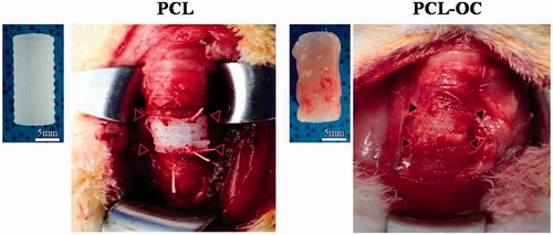 Figure 3. Surgical procedure of tracheal scaffold implantation in rabbit: a 1-cm length circumferential trachea has been removed, and a 3D-printed PCL scaffold, with or without omental culture, implanted into the defect site (arrow-head). PCL: polycaprolactone scaffold group, PCL-OC: PCL scaffold cultured in omentum for 2 weeks before transplantation group.