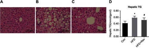 Figure 4 Hepatic lipid deposition after resveratrol group. (A–C). H&E staining of liver tissue after resveratrol treatment. (A) Con group had normal liver morphology. (B). HFD group had a large number of lipid droplet vacuoles. (C). Group had less vacuoles compared with HFD alone. (D) Hepatic TG content after resveratrol treatment. One-way ANOVA was used for statistical analysis followed by a post hoc least significant difference test. *P<0.05 vs Con group. #P<0.05 vs HFD group.Abbreviations: Con, control group; HFD, high-fat diet group; HFD + Rev, high-fat diet + resveratrol group.